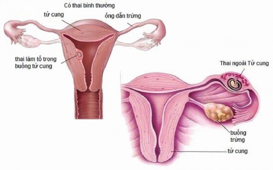 viem nhiem sinh duc nu 4 550x343 - Viêm nhiễm bộ phận sinh dục ở nữ giới